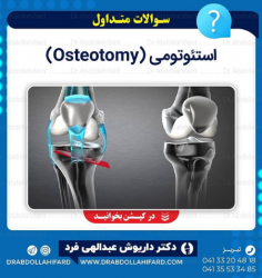 استئوتومی (Osteotomy)