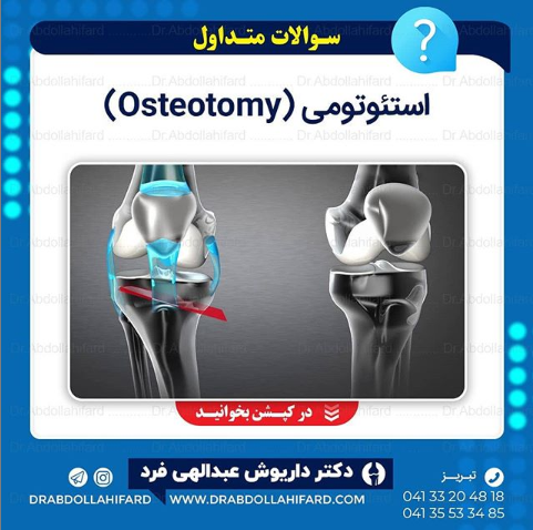 استئوتومی (Osteotomy)
