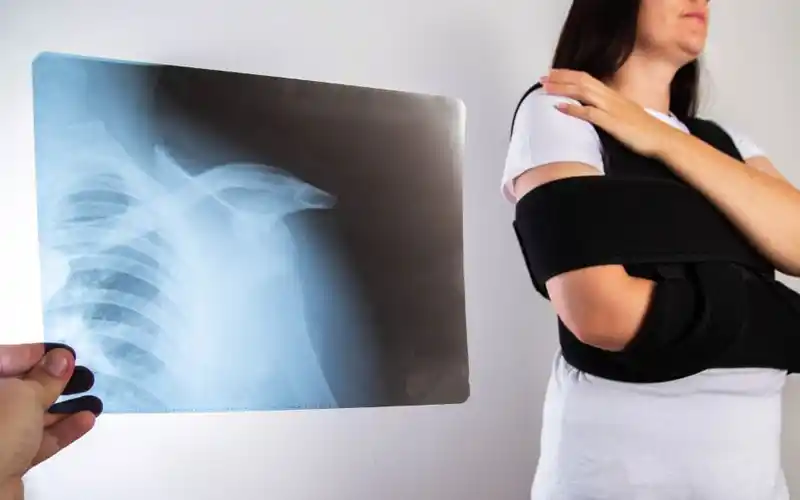 استراحت و تثبیت شانه