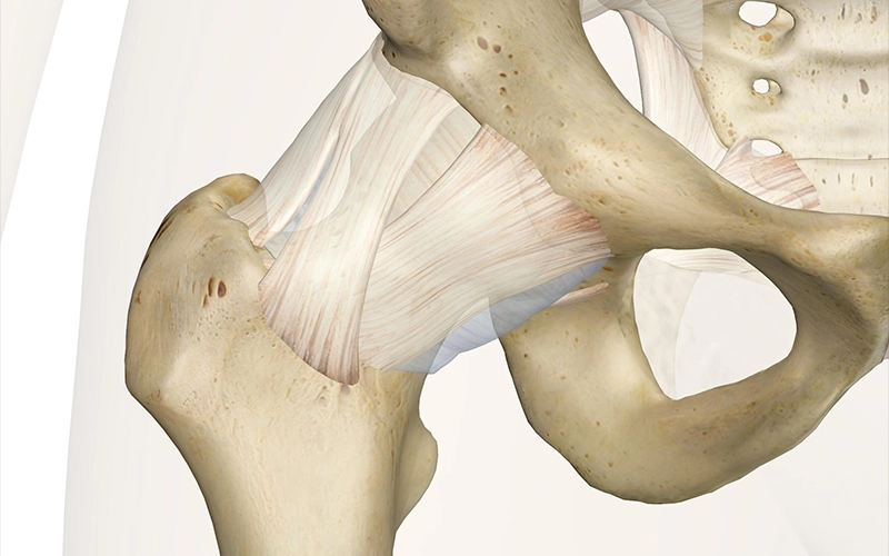 جراحی تعویض مفصل ران