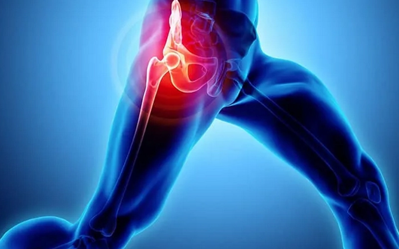 ساییدگی مفصل ران