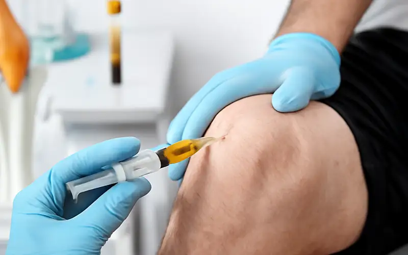 ACS یا Autologous Conditioned Serum