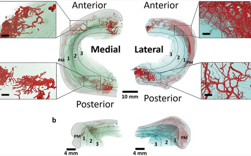 Knee Menisci